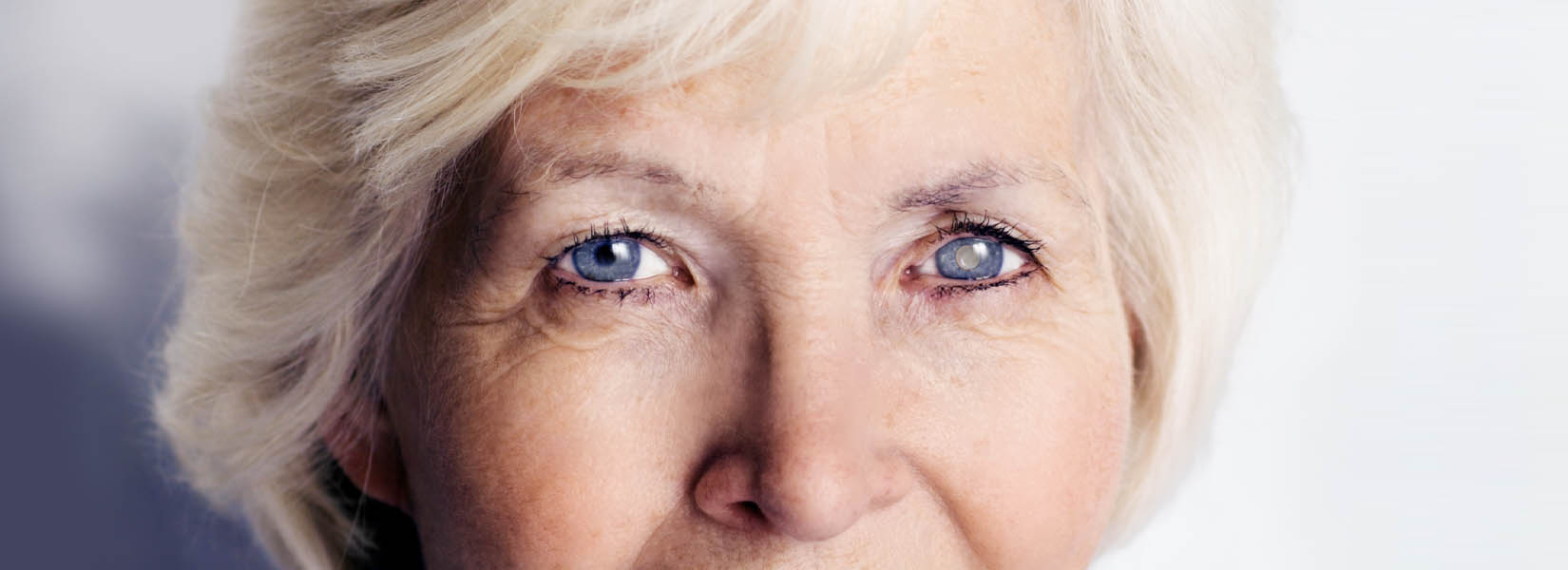 Cataract Surgery in Saint Charles